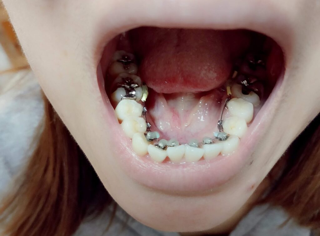 orthodontics4