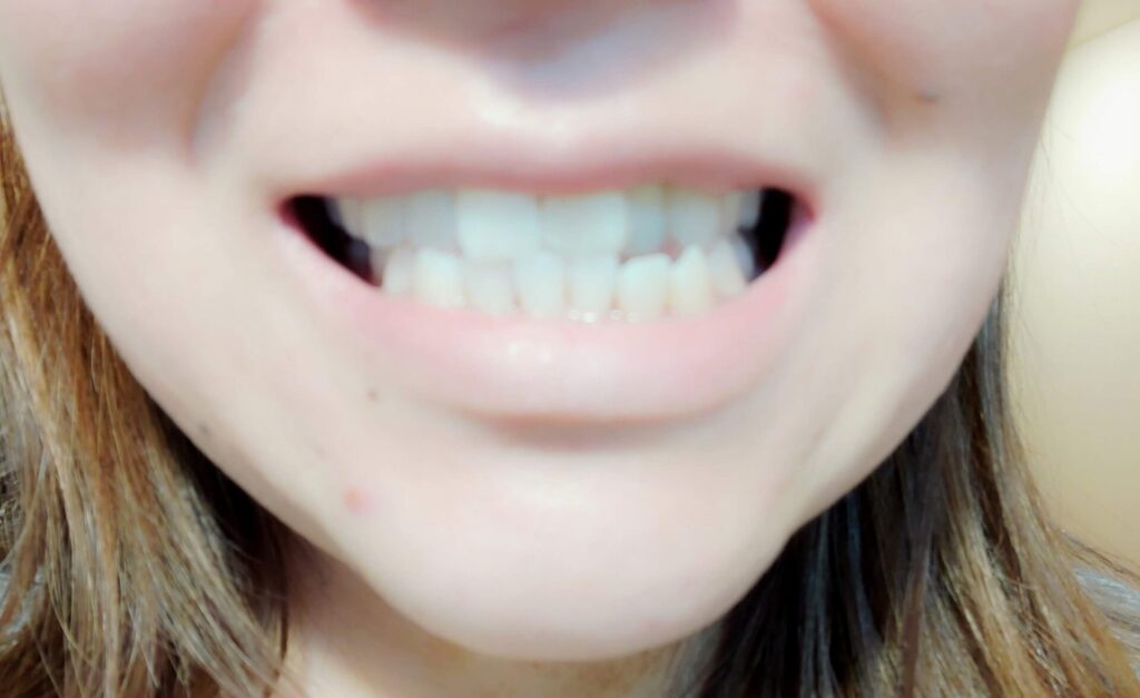 orthodontics3